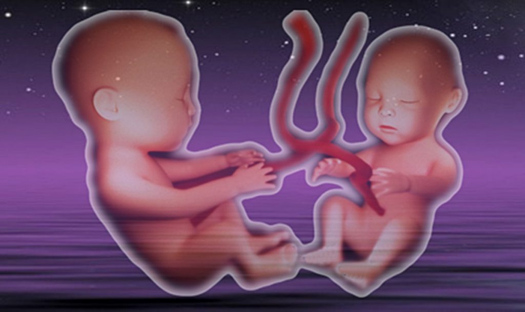 Das Drama des ungeborenen Zwillings